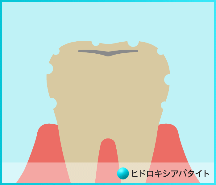 ミカホワイトで歯は白くなる 気になる効果や口コミ 評判を調査してみた Beautywalker ミカホワイトで歯は白くなる 気になる効果や口コミ 評判を調査してみた Beautywalker