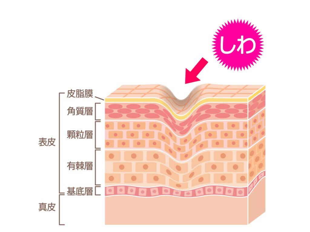 気になるシワにアプローチ しワが出来るの原因をもとにシワ改善に効果的なクリームをご紹介